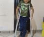 Solidaridad, el Milagro Oaxaqueño en apoyo del niño  David Morán con Síndrome de Legg-Calvé Perthes