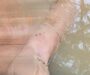 Salió A Una Clínica Estética… Y Terminó Muerta